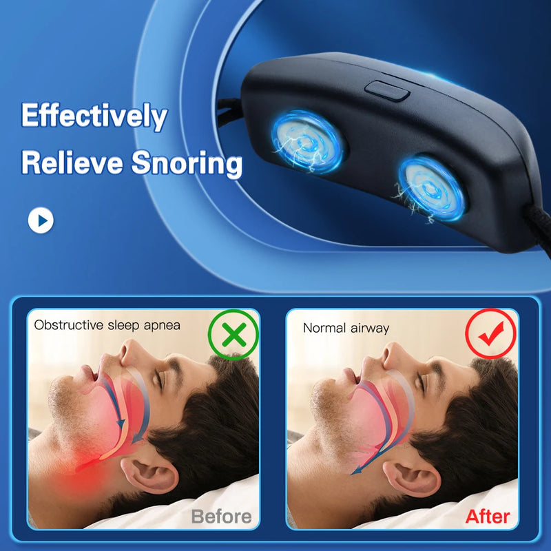 Smart Anti Snoring Device EMS Pulse Stop Snoring Effective Solution Snore Sleeping Aid Noise Reduction Sleep Care